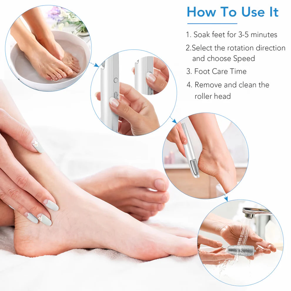 Lissteps® - Removedor de callos