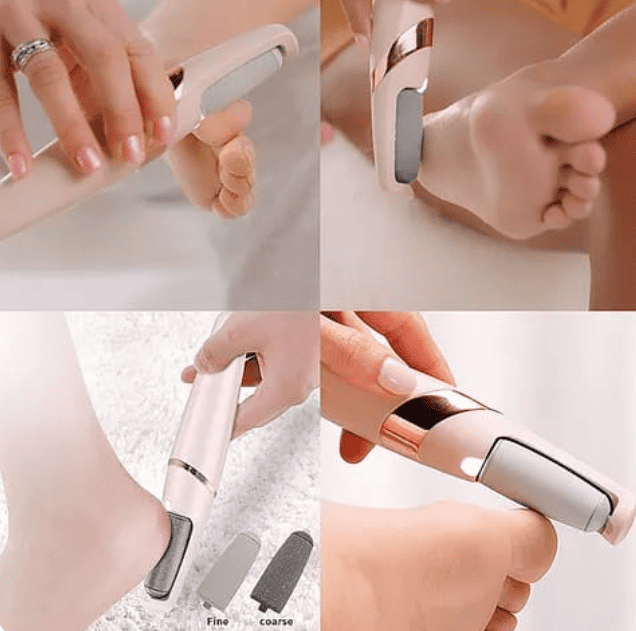 Lissteps® - Removedor de callos