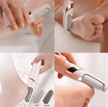 Lissteps® - Removedor de callos